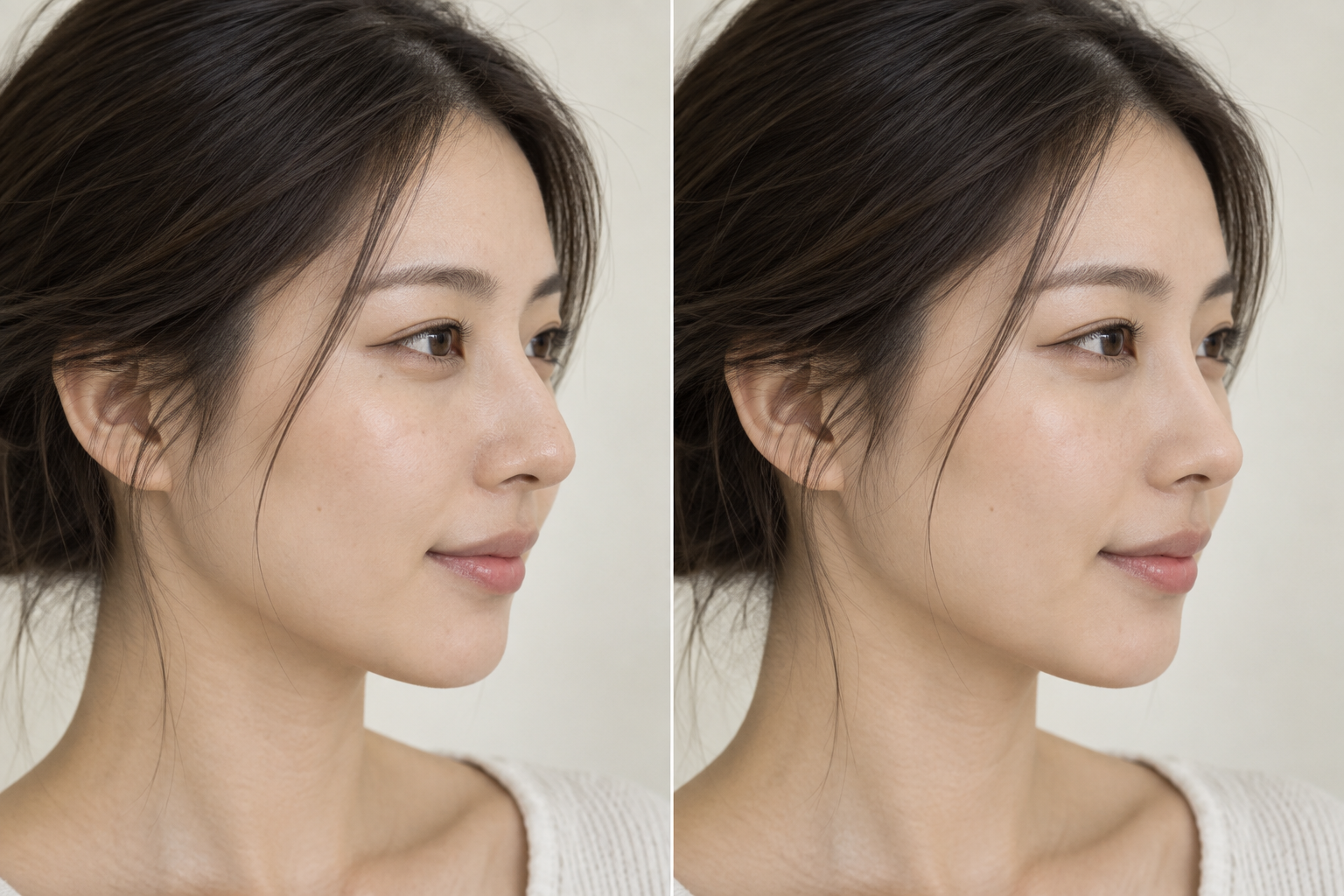 구조적 코성형 센터 가상 비포 애프터 비교 이미지